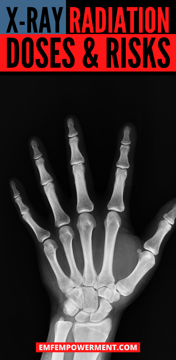 X-Ray Radiation Exposure: Doses & Risks